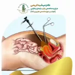 جراحی لاپاراسکوپی