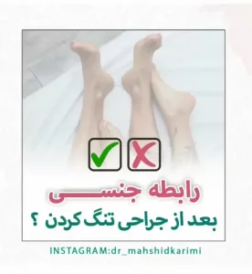 زمان رابطه بعد از تنگ کردن واژن