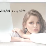عفونت پس از لابیاپلاستی