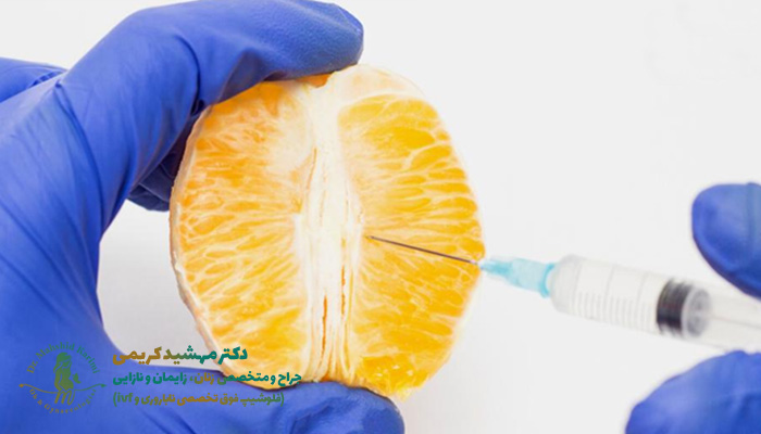 تزریق چربی به واژن در تهران