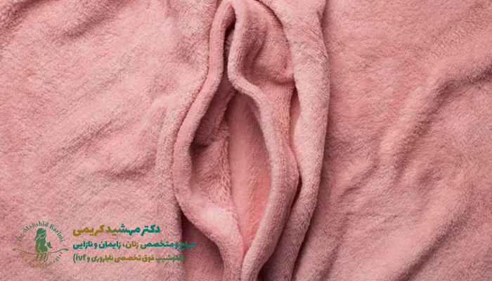 جراحی تنگ کردن واژن یا واژینوپلاستی
