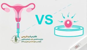 تفاوت آی ‌وی‌ اف و آی ‌یو ‌آی