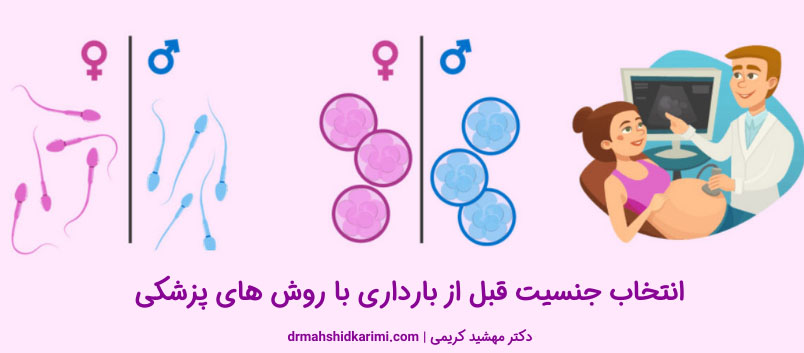 انتخاب جنسیت قبل از بارداری