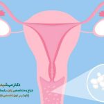 درمان عفونت مکرر واژن