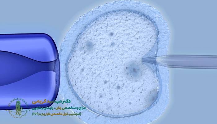 بهترین سن برای IVF